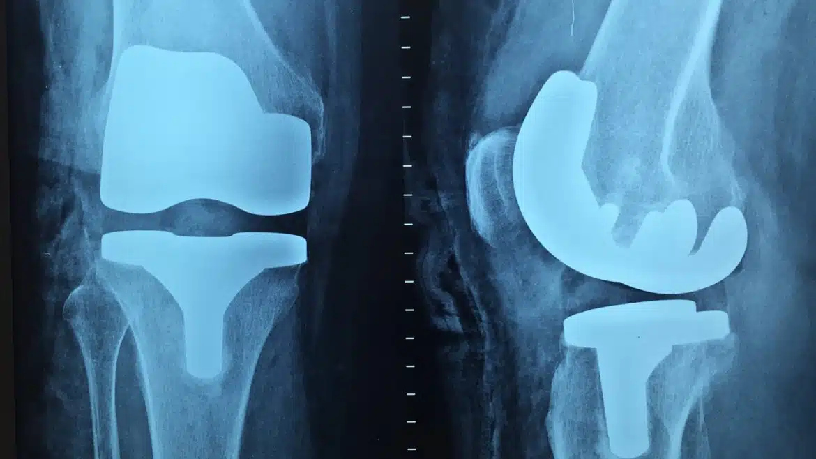 Quel est le rôle du chirurgien orthopédiste ?